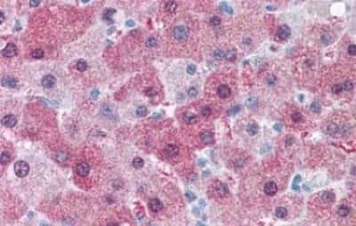 Immunohistochemistry-Paraffin: GCNT3 Antibody [NBP3-14332] - GCNT3 antibody IHC of human liver. Immunohistochemistry of formalin-fixed, paraffin-embedded tissue after heat-induced antigen retrieval.